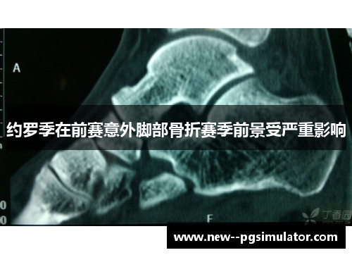 约罗季在前赛意外脚部骨折赛季前景受严重影响 约罗季在前赛意外脚部骨折赛季前景受严重影响